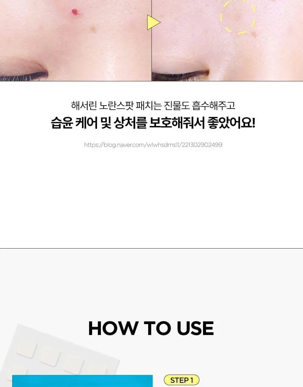 [올영단독기획 / 짜기 전/후 구성] 해서린 스팟케어 패치 키트 대용량 기획 140매 상세페이지 30